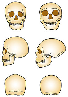 2 colonnes de 3 dessins de comparaison de contours de crâne de face, de gauche et de derrière et de dessus.